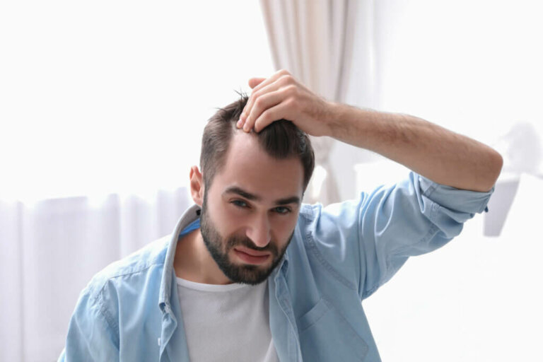7 mythes sur la perte de cheveux