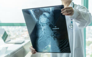 Las 7 principales enfermedades de la columna vertebral
