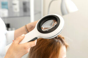 Los 7 tipos de alopecia
