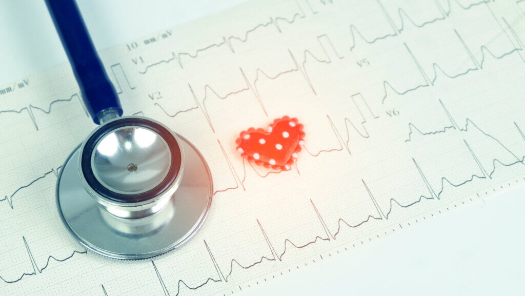 A síndrome de Brugada tem vários métodos diagnósticos