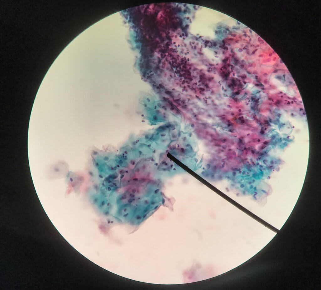 Con la citología se visualizan células