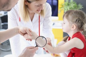 Tratamiento del vitíligo en niños