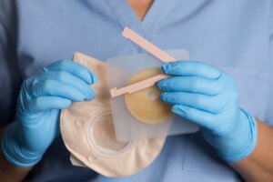 ¿Qué es una ileostomía?