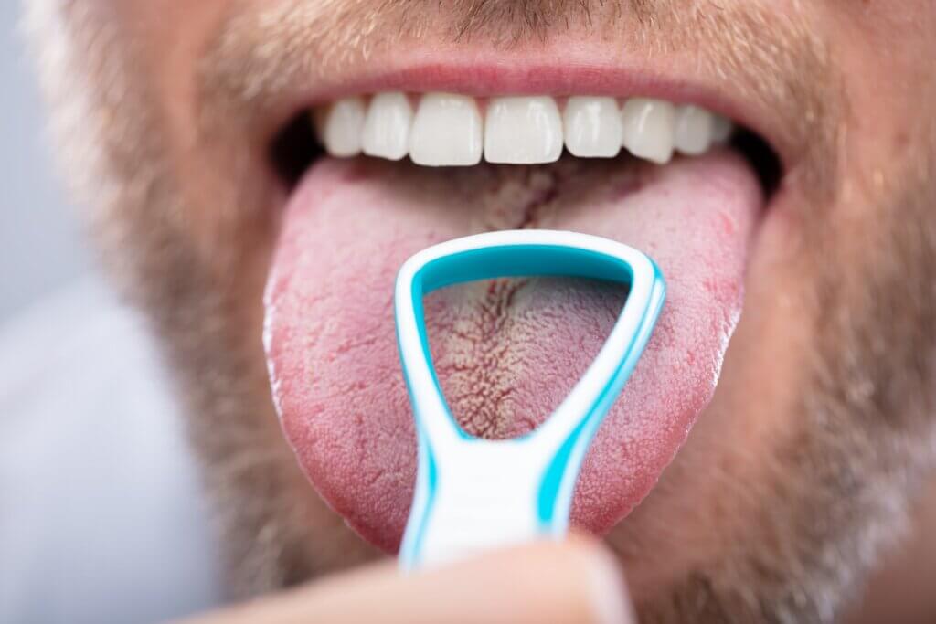 El raspado de lengua es muy útil