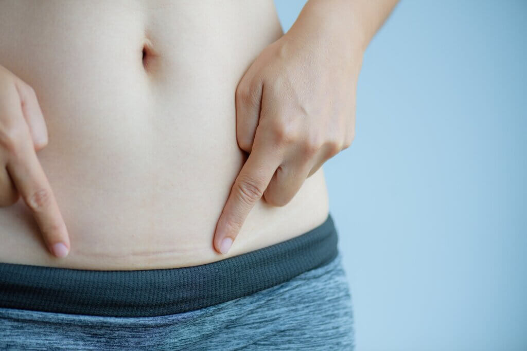 El dolor de ingle en mujeres