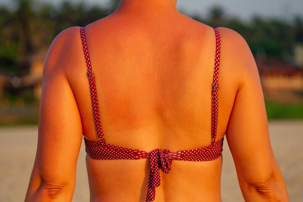 El bronceado y cortisol están relacionados