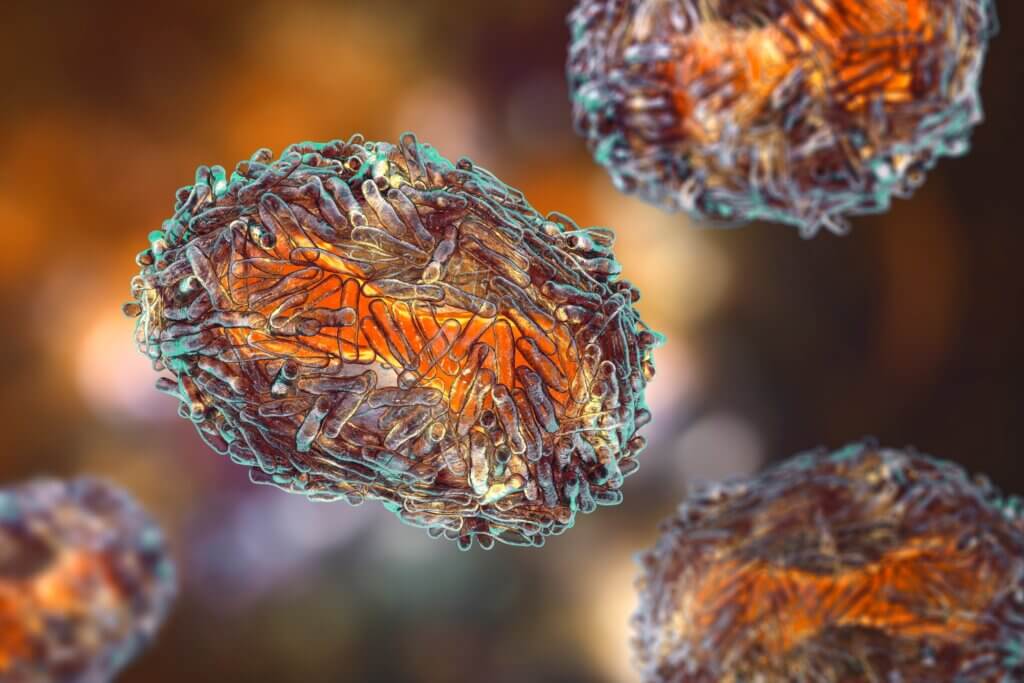 Verschillen tussen neurofibromatose en apenpokken omvatten hun oorsprong