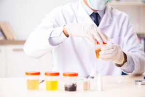 Grasa en la orina: causas y qué hacer