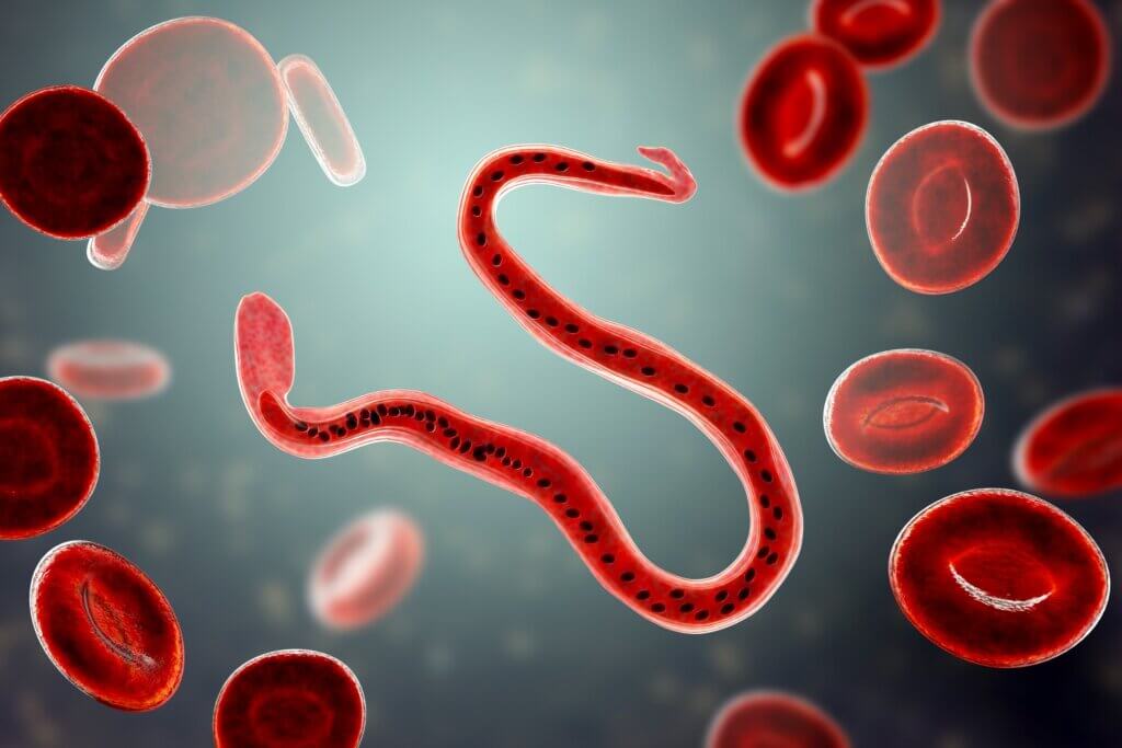 Het vet in de urine in het filariaal