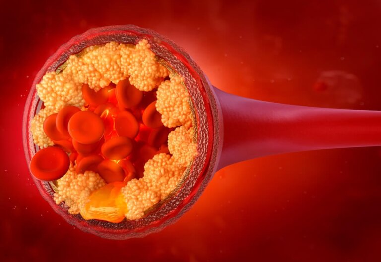 Why Do Cholesterol Levels Rise?