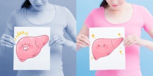 Fígado gorduroso: sintomas, causas e tratamento