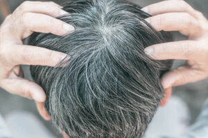 Ecco come invecchiano i capelli