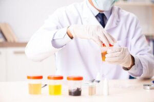 Fat in Urine: Causes and What to Do