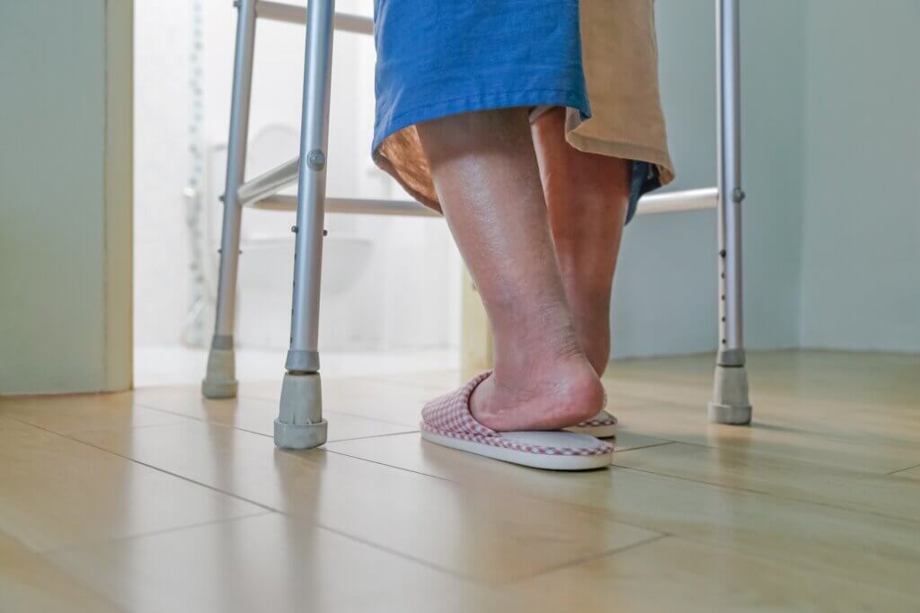 Fluid Retention: Why Does It Happen?