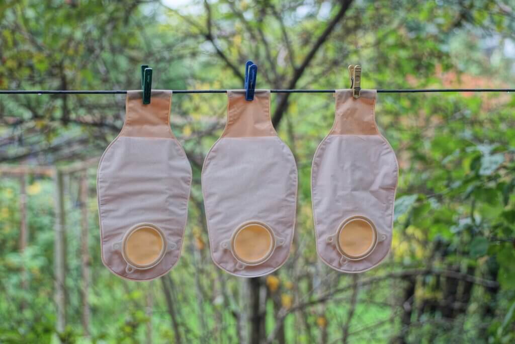 Vivre avec une iléostomie signifie une meilleure hygiène
