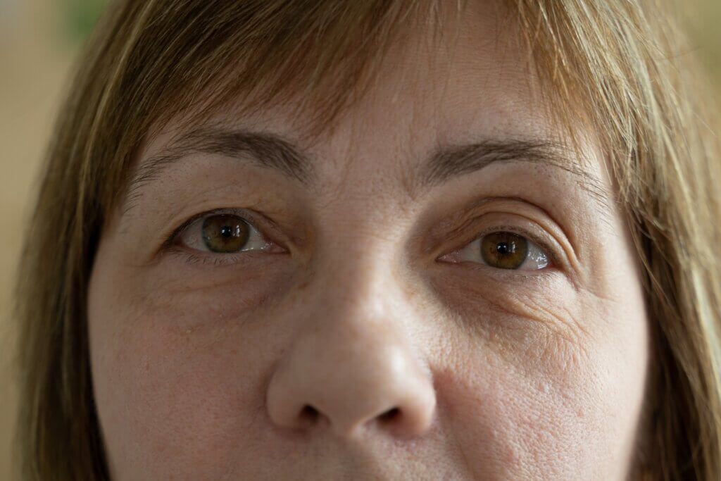 Skin changes after 50 are notorious.