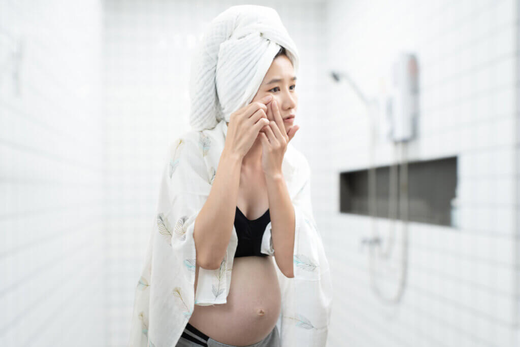 Acne na gravidez: por que aparece e como prevenir