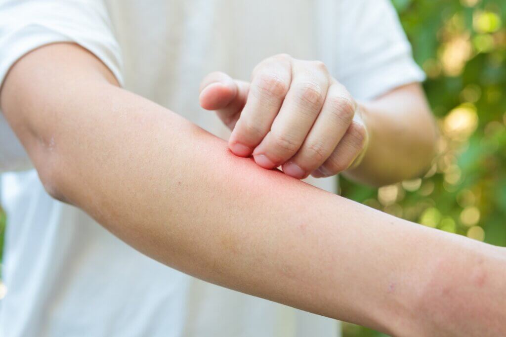 Las infecciones en la piscina incluyen las dermatitis