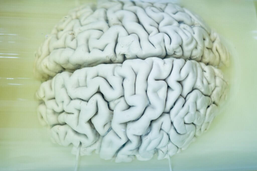 Las alteraciones de los movimientos inducidos tienen varias causas