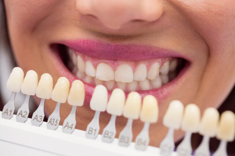 ¿Cuáles son los efectos secundarios de un blanqueamiento dental?