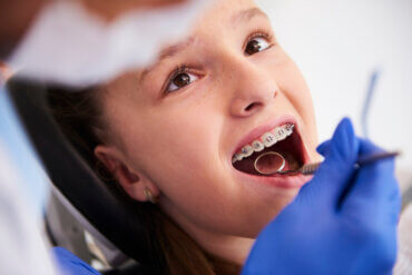 Ortodoncia: qué es y cuáles son sus beneficios