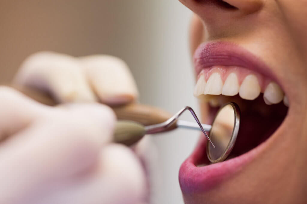 Los efectos secundarios del blanqueamiento dental son variados