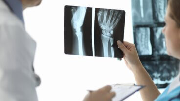 Enfermedad ósea de Paget: causas, síntomas y tratamiento