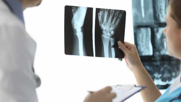 Enfermedad ósea de Paget: causas, síntomas y tratamiento